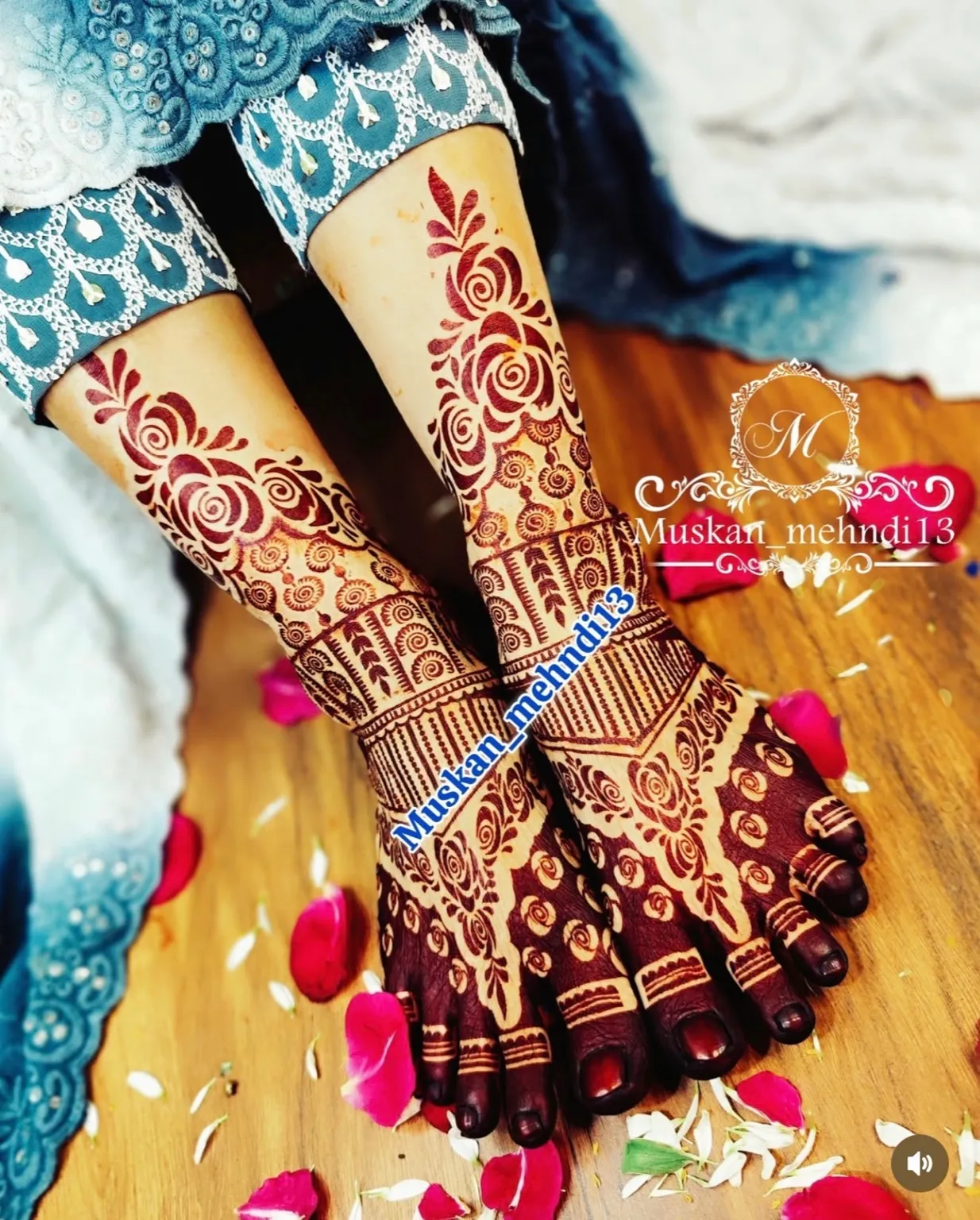 DL1 (for 1 person both legs)