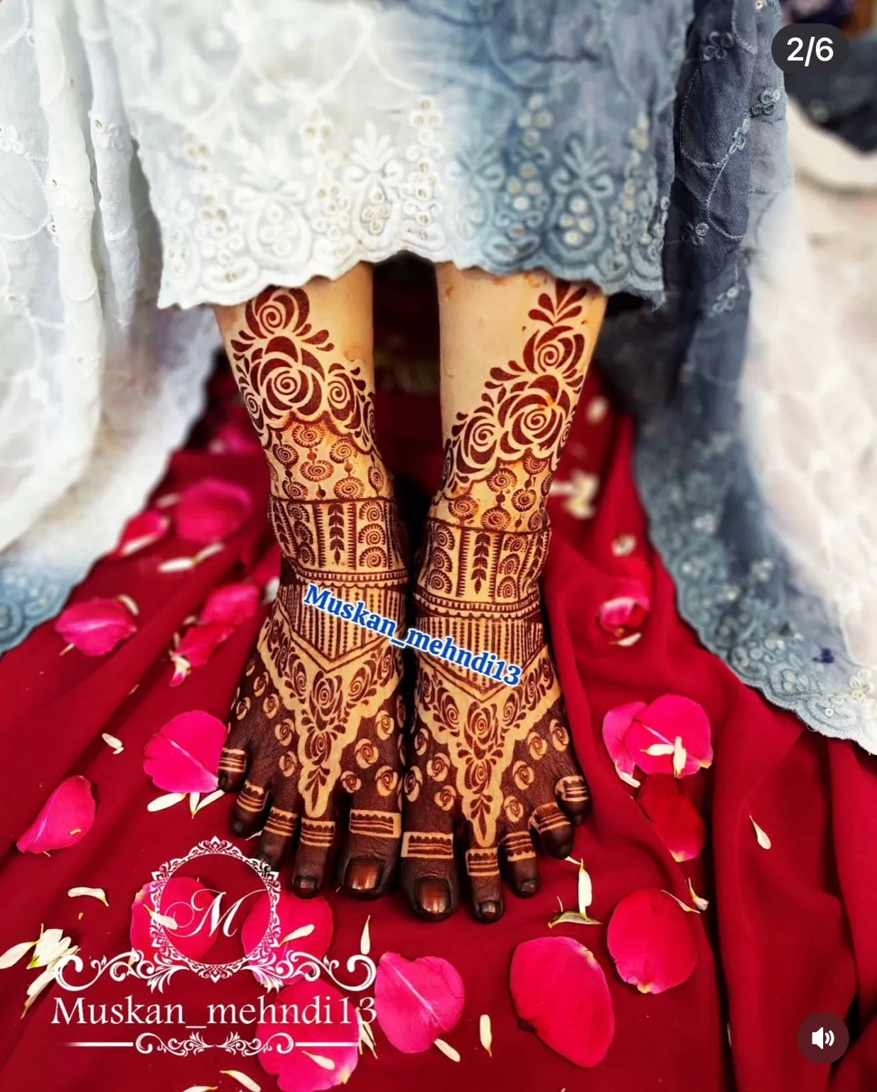 DL1 (for 1 person both legs) - Image 4