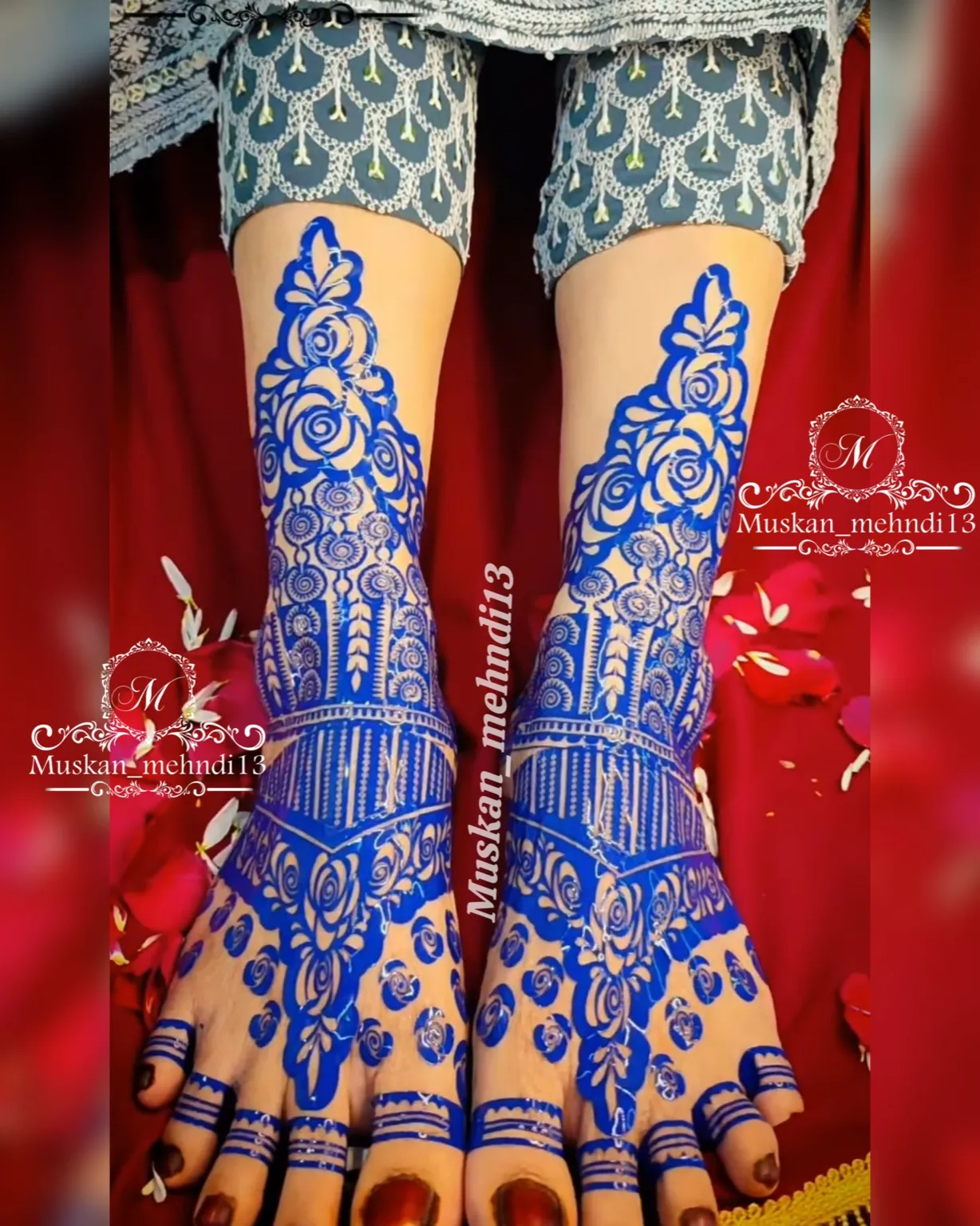 DL1 (for 1 person both legs) - Image 3