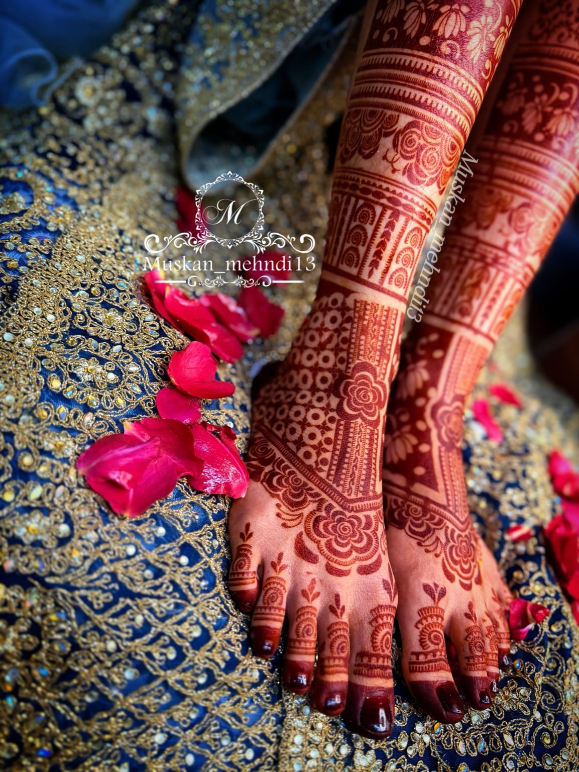 DL2 (for 1 person both legs ) - Image 7