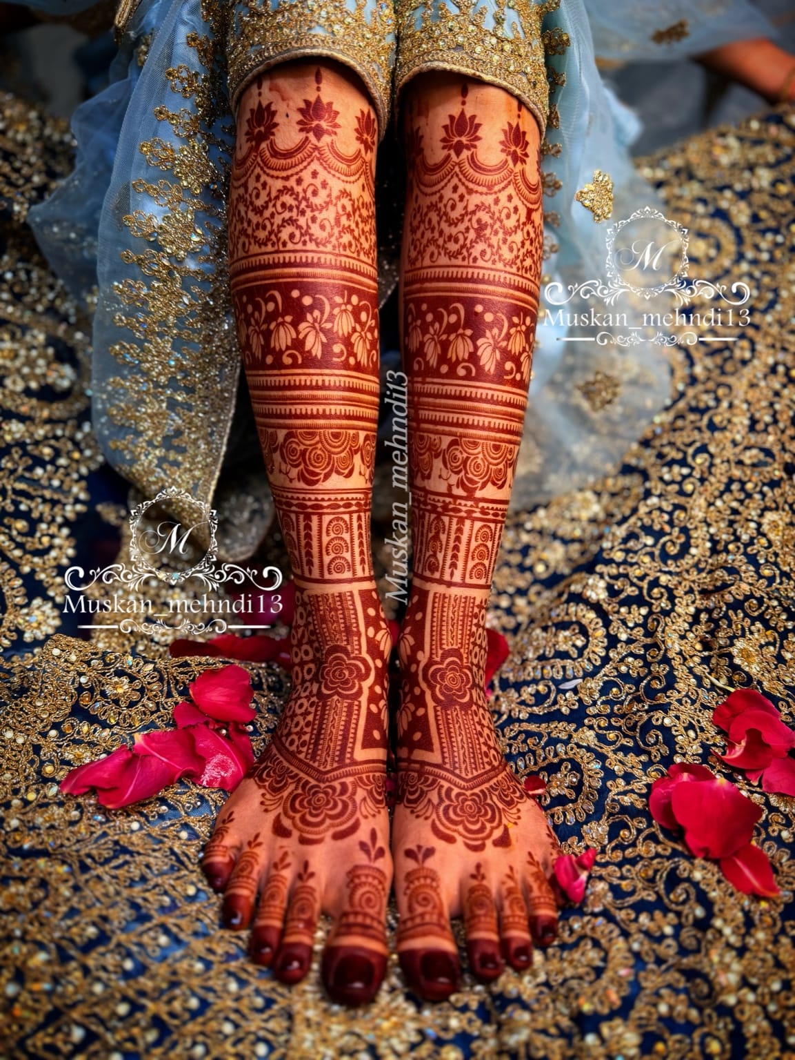 DL2 (for 1 person both legs )