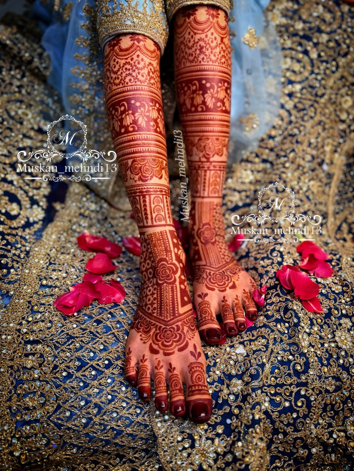 DL2 (for 1 person both legs ) - Image 5