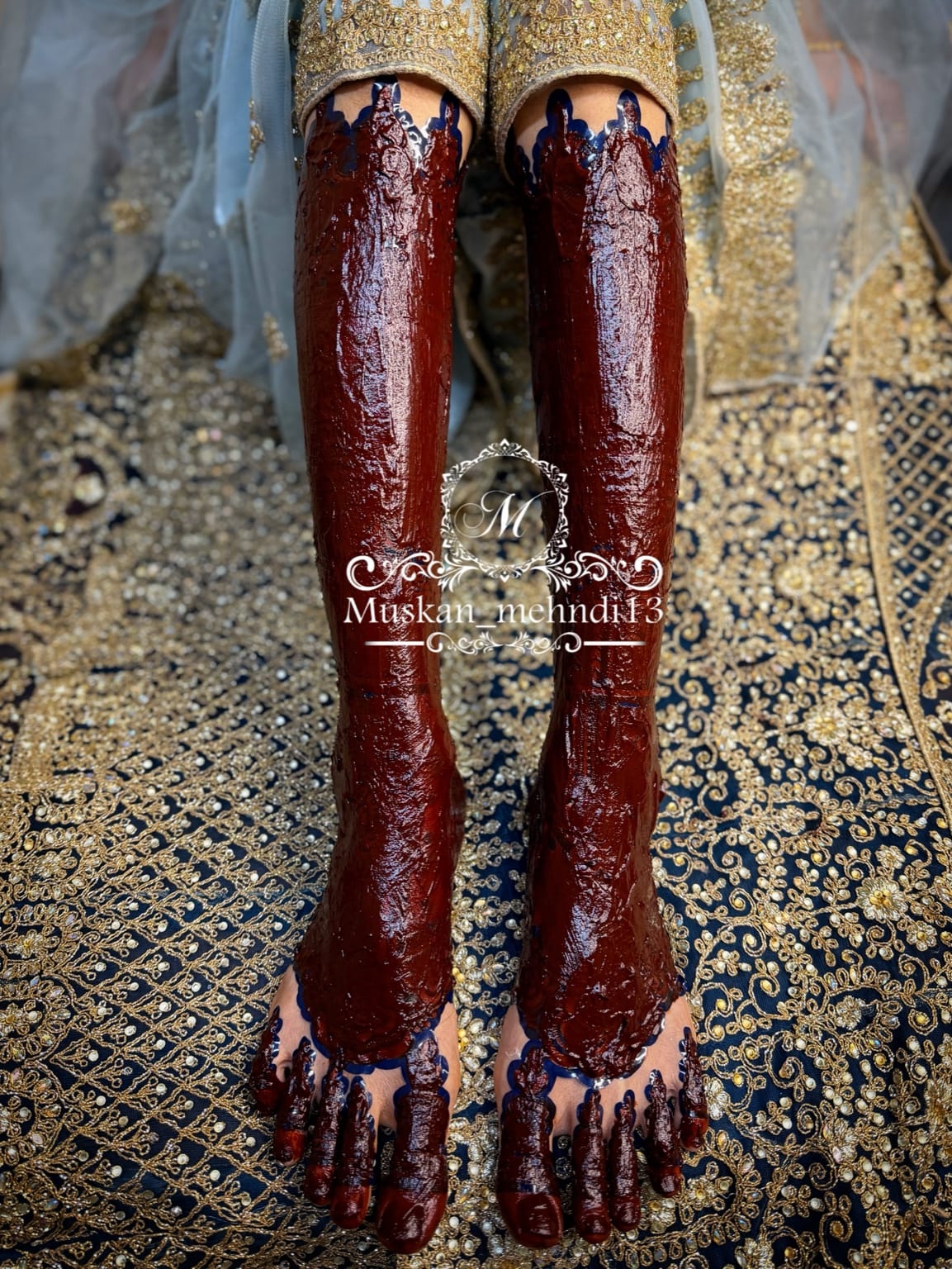 DL2 (for 1 person both legs ) - Image 4