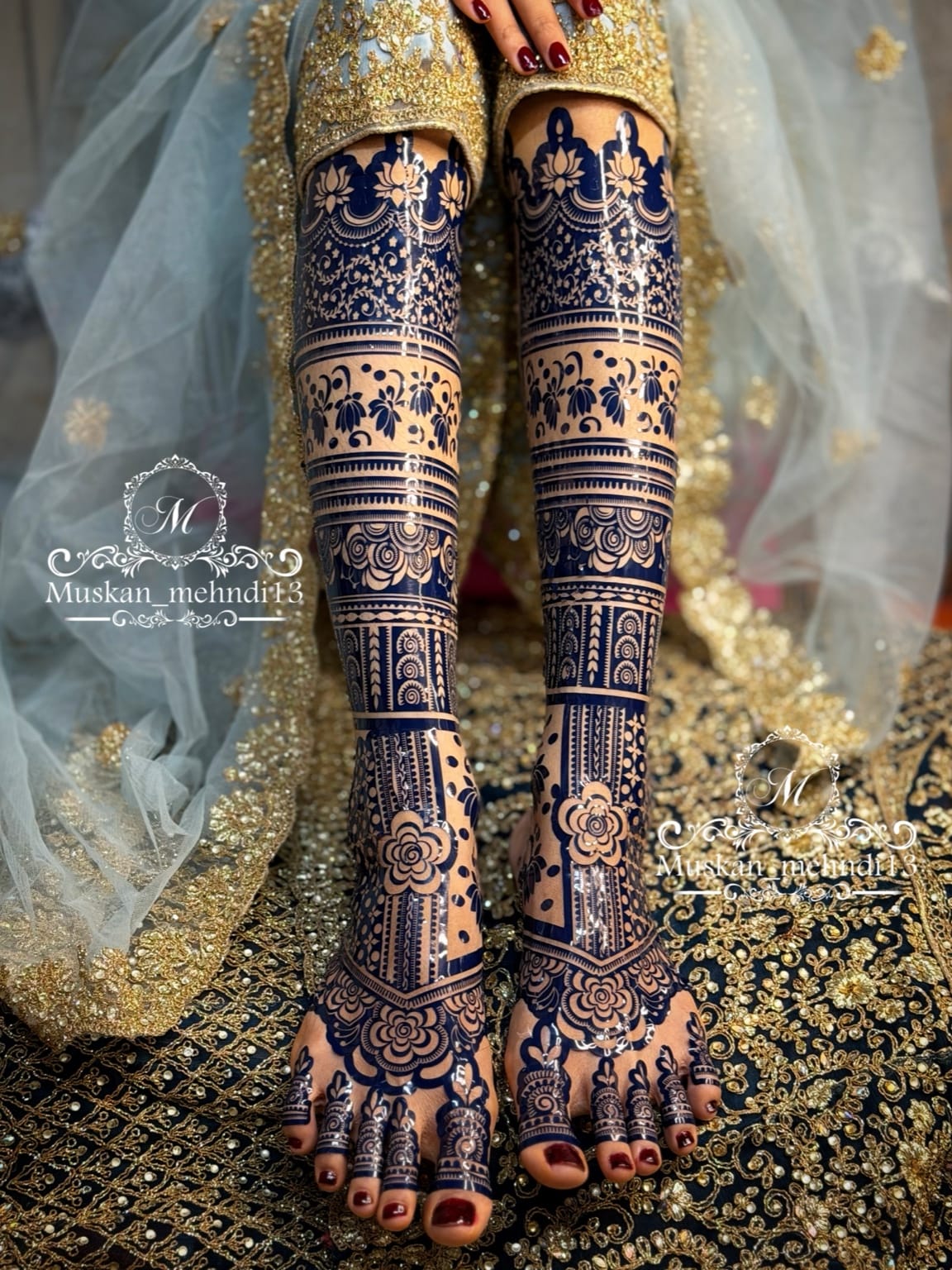 DL2 (for 1 person both legs ) - Image 3