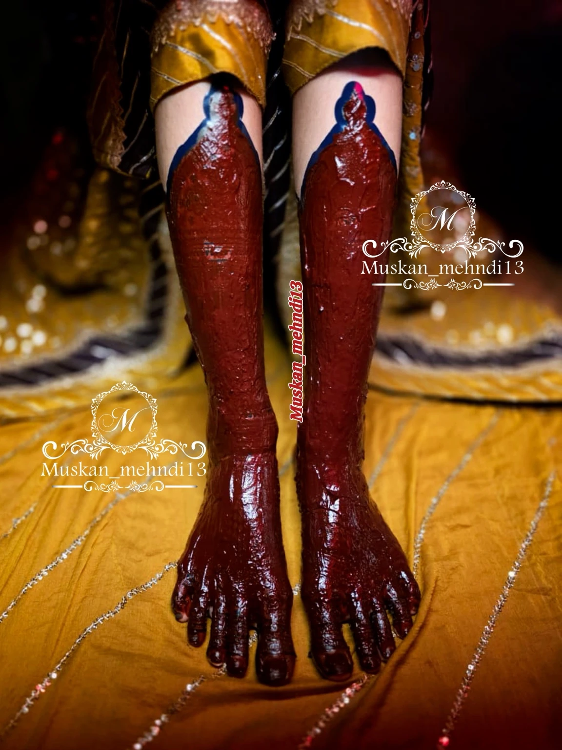 DL5 (for 1 person both legs ) - Image 4