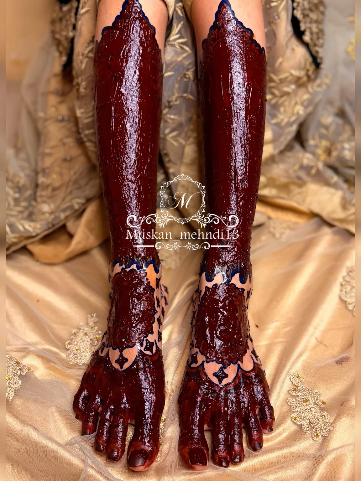 DL6 (for 1 person both legs ) - Image 4