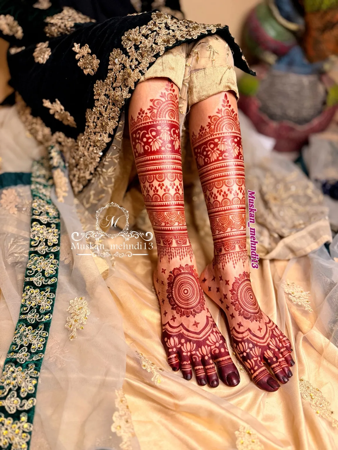 DL6 (for 1 person both legs ) - Image 6