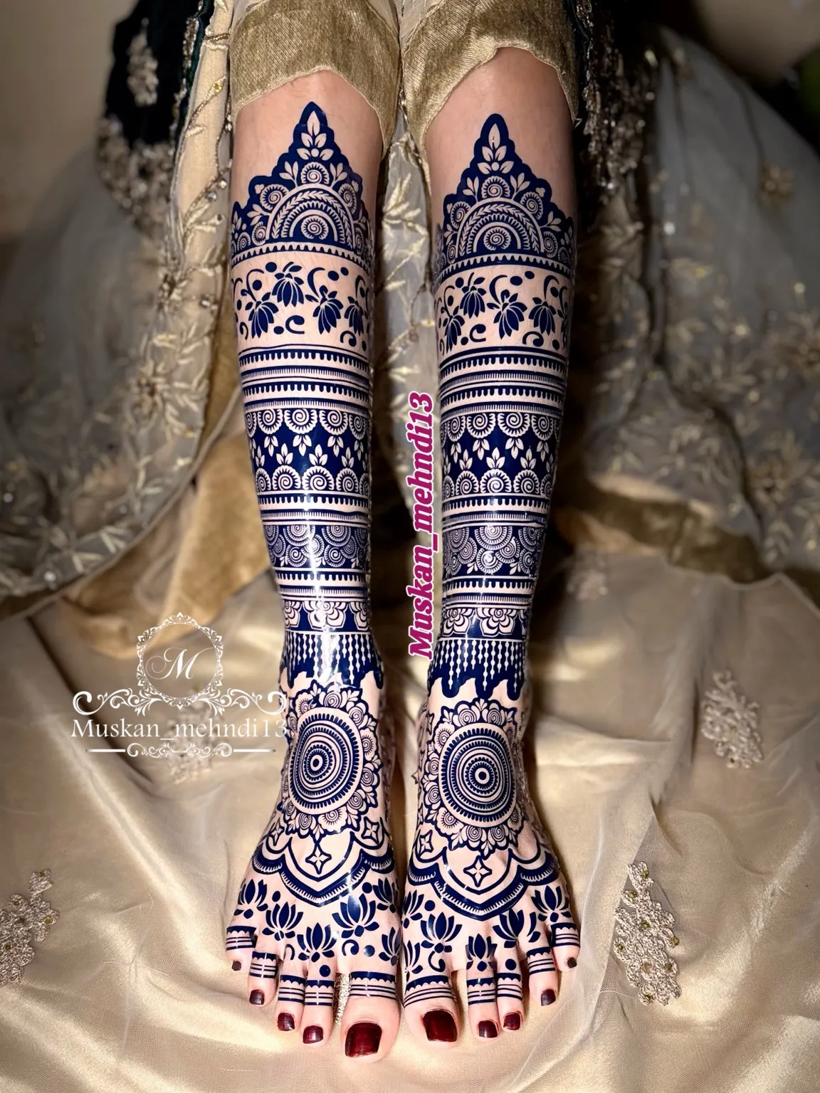 DL6 (for 1 person both legs ) - Image 3