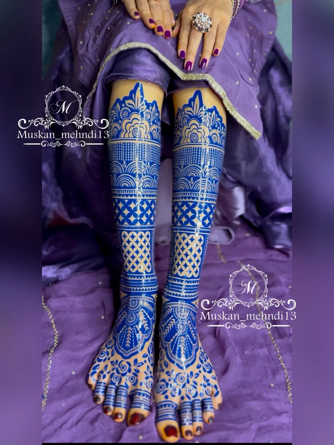 DL7 (for 1 person both legs ) - Image 3