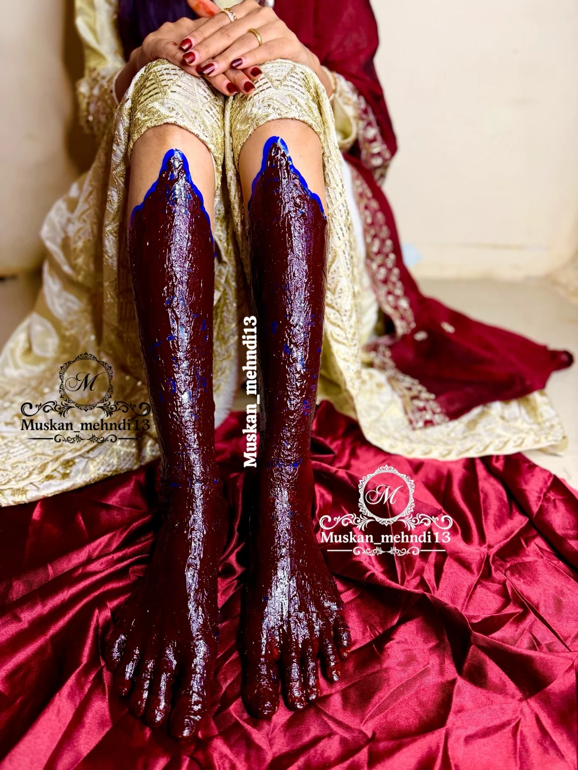DL9 (for 1 person both legs ) - Image 4
